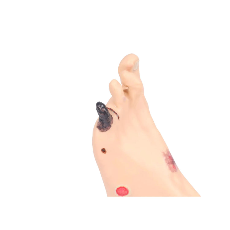 Modèle de pied avec plaies - Anatomie et pathologie My Podologie 