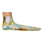 Flat foot model - Herbitas